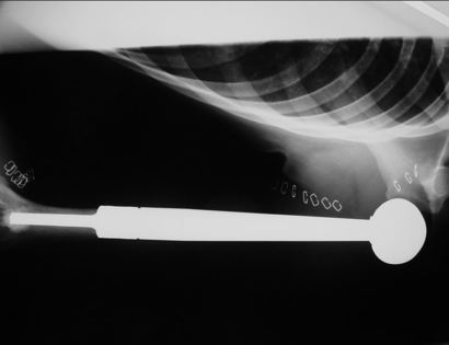 Total Humerus X-Ray Photo 