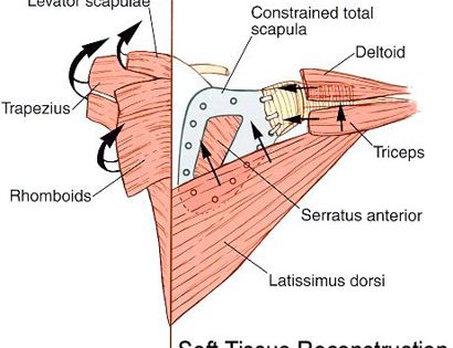 Total Scapula Soft Tissue