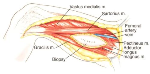 Blood Vessel and Nerve Dissection