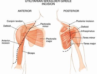 Utilitarian Incision 